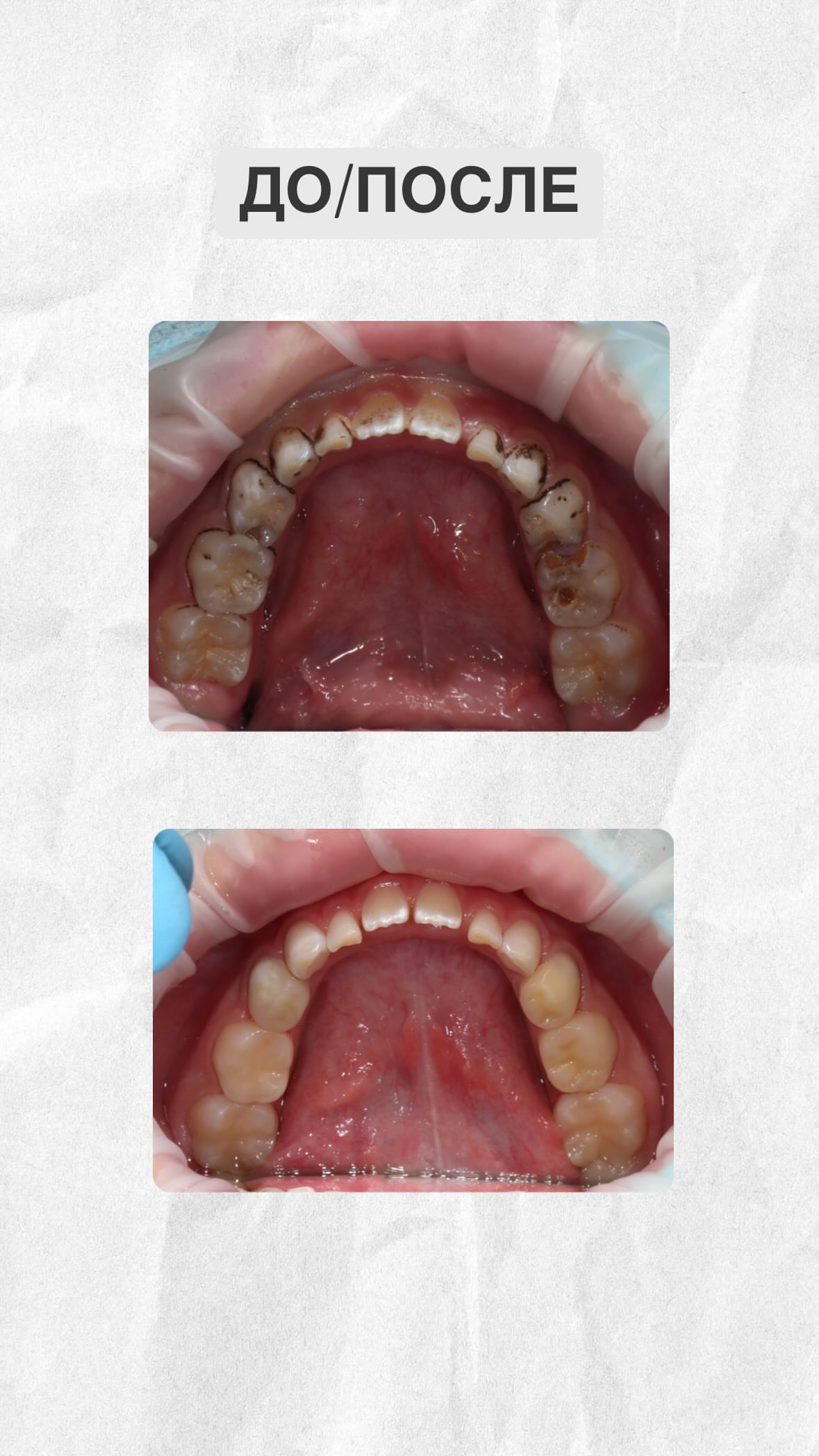 Результат лечения до/после