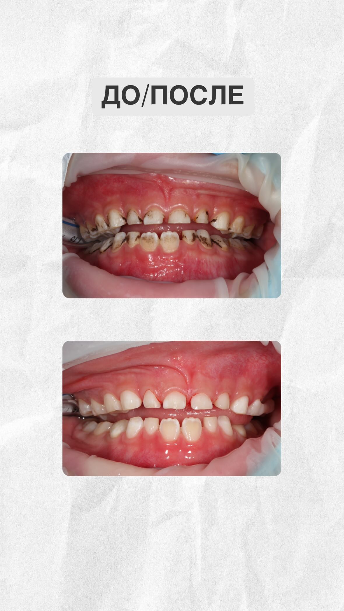 Результат лечения до/после