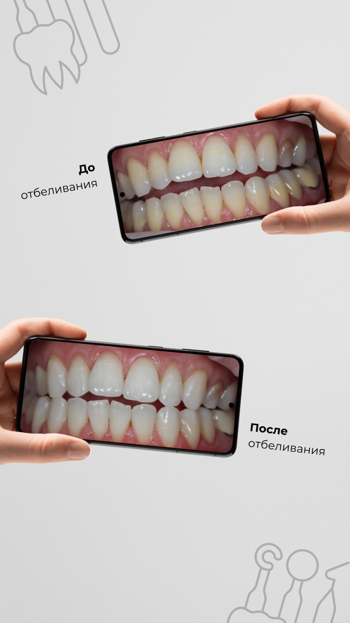 Результат лечения до/после