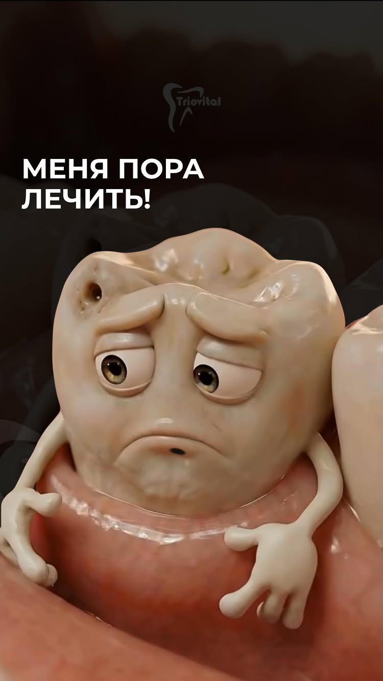 Лечение пульпита